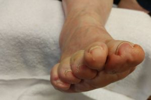 Medical Pedicures | Boise, Idaho